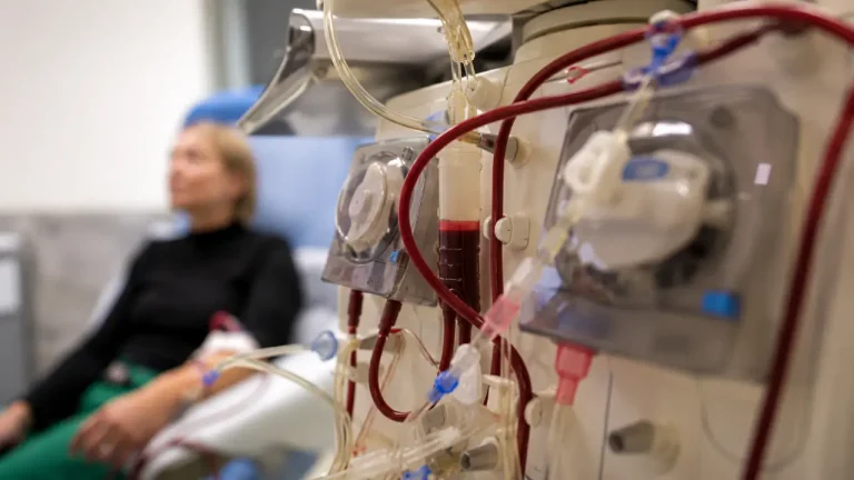 Dialysis Kidney Machine
